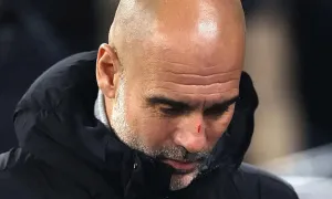 Vì sao Guardiola có nhiều vết xước trên mặt?