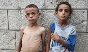 Những đứa trẻ da bọc xương ở Gaza Những đứa trẻ da bọc xương ở Gaza
